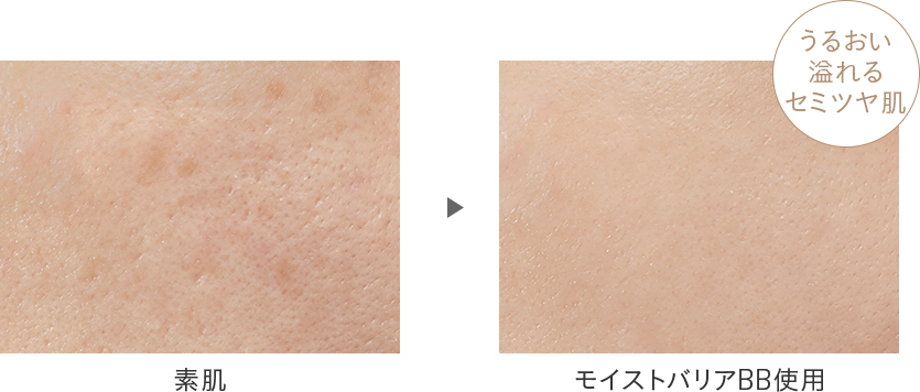 Before After画像