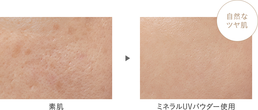 Before After
