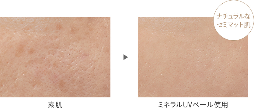 Before After